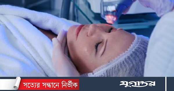 ব্রণ দূর করতে যে চিকিৎসা জনপ্রিয়তা পাচ্ছে