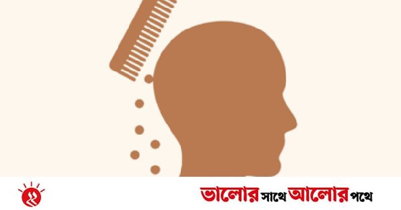 চুল পড়ার কারণ যখন খুশকি | প্রথম আলো