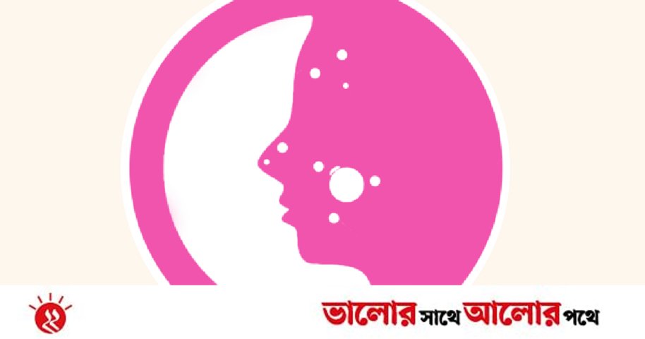 কিশোরীদের অতিরিক্ত ব্রণে যত্ন | প্রথম আলো