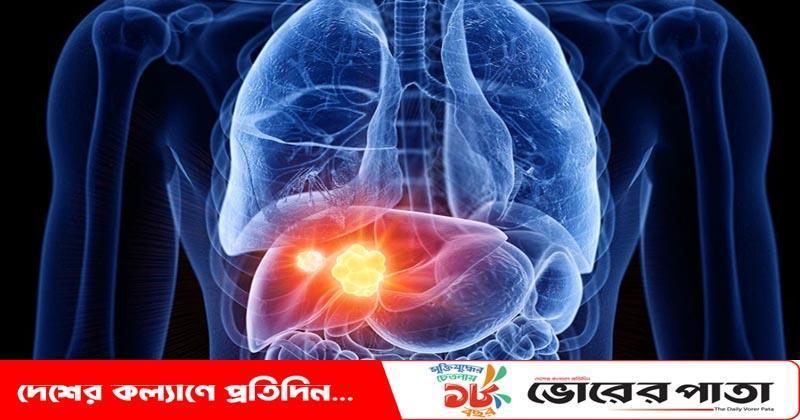 লিভার নষ্ট হওয়ার ৫ লক্ষণ