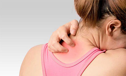 দৈনন্দিন জীবনে এলার্জি ও করণীয়