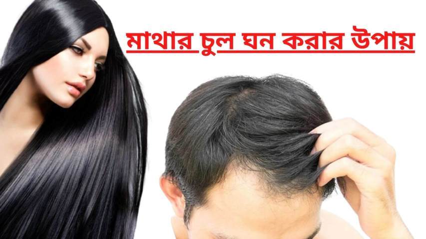 মাথার পাতলা চুল ঘন করার উপায় | উইকিপিডিয়া