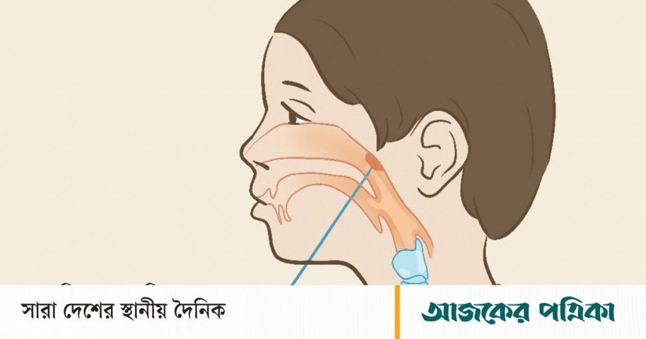 শিশু কি হাঁ করে ঘুমায়, নাক ডাকে