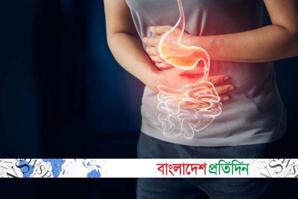 অ্যাসিডিটি থেকে মুক্তির সহজ ঘরোয়া উপায় | Online Version