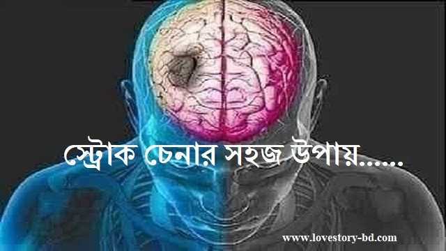 স্ট্রোক চেনার সহজ উপায় - Love Story BD - ভালোবাসার গল্প