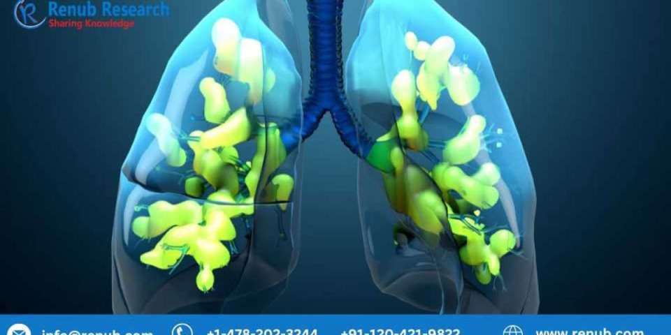 Acute Respiratory Distress Syndrome Market | Growth Forecast | 2028
