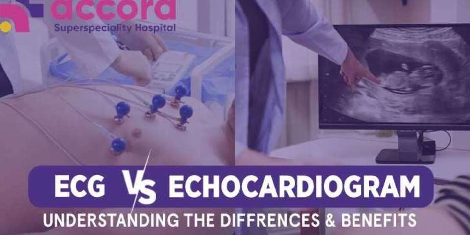 ECG vs. Echocardiogram – Understanding the Differences and Benefits