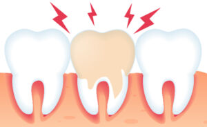 Emergency Dentist San ****go - Brite Smile Dental