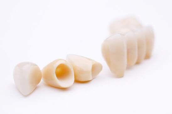 Dental Crowns & Bridges Dee Why | Kingsway Dental