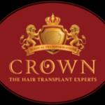 Crown hair