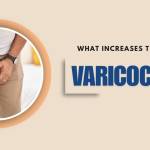 Best varicocele treatment