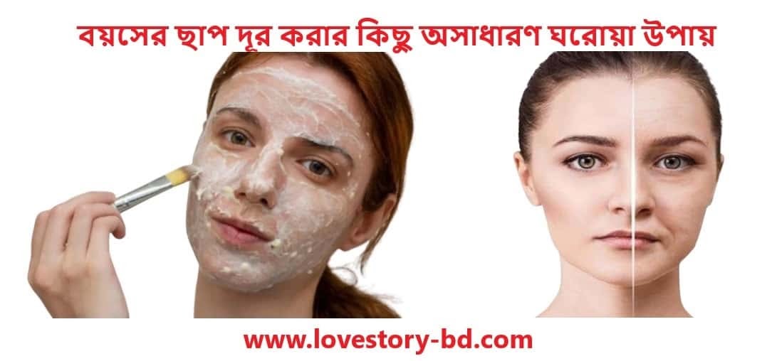 বয়সের ছাপ দূর করার কিছু অসাধারণ ঘরোয়া উপায় - Love Story BD - ভালোবাসার গল্প