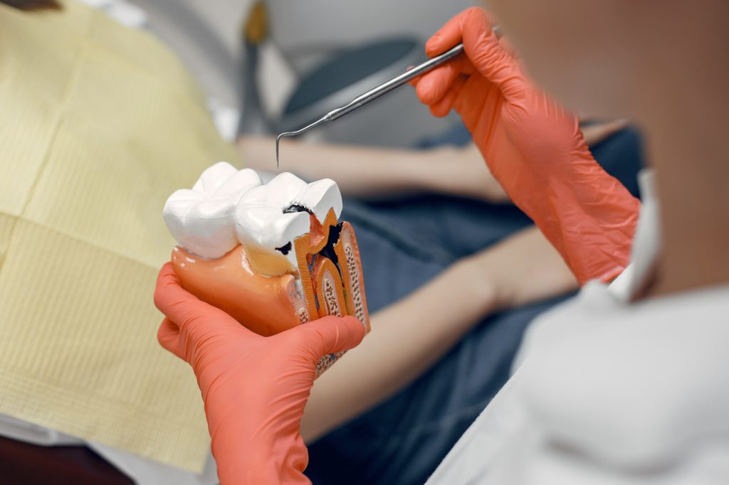 Best Endodontist in Abu Dhabi | Hollywood Smile Center