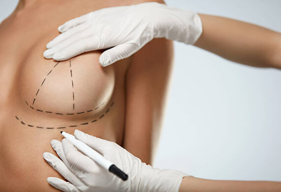 Dr. Priya Bansal | Expert Care in Breast Reduction Surgery for Comfort & Confidence