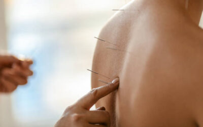 8 Ways an Acupuncture Clinic Supports Women’s Health – View Pen
