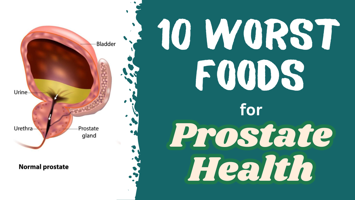Ten Worst Foods for Prostate Health