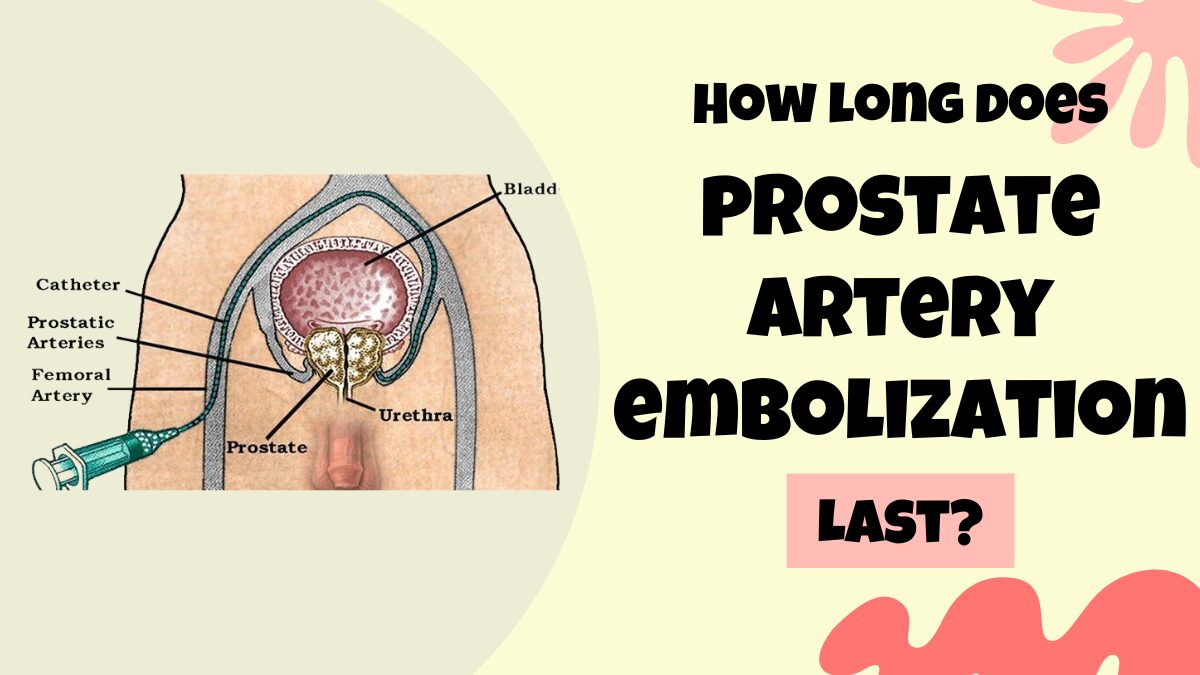 How long does prostate artery embolization last? - MedinfoBox